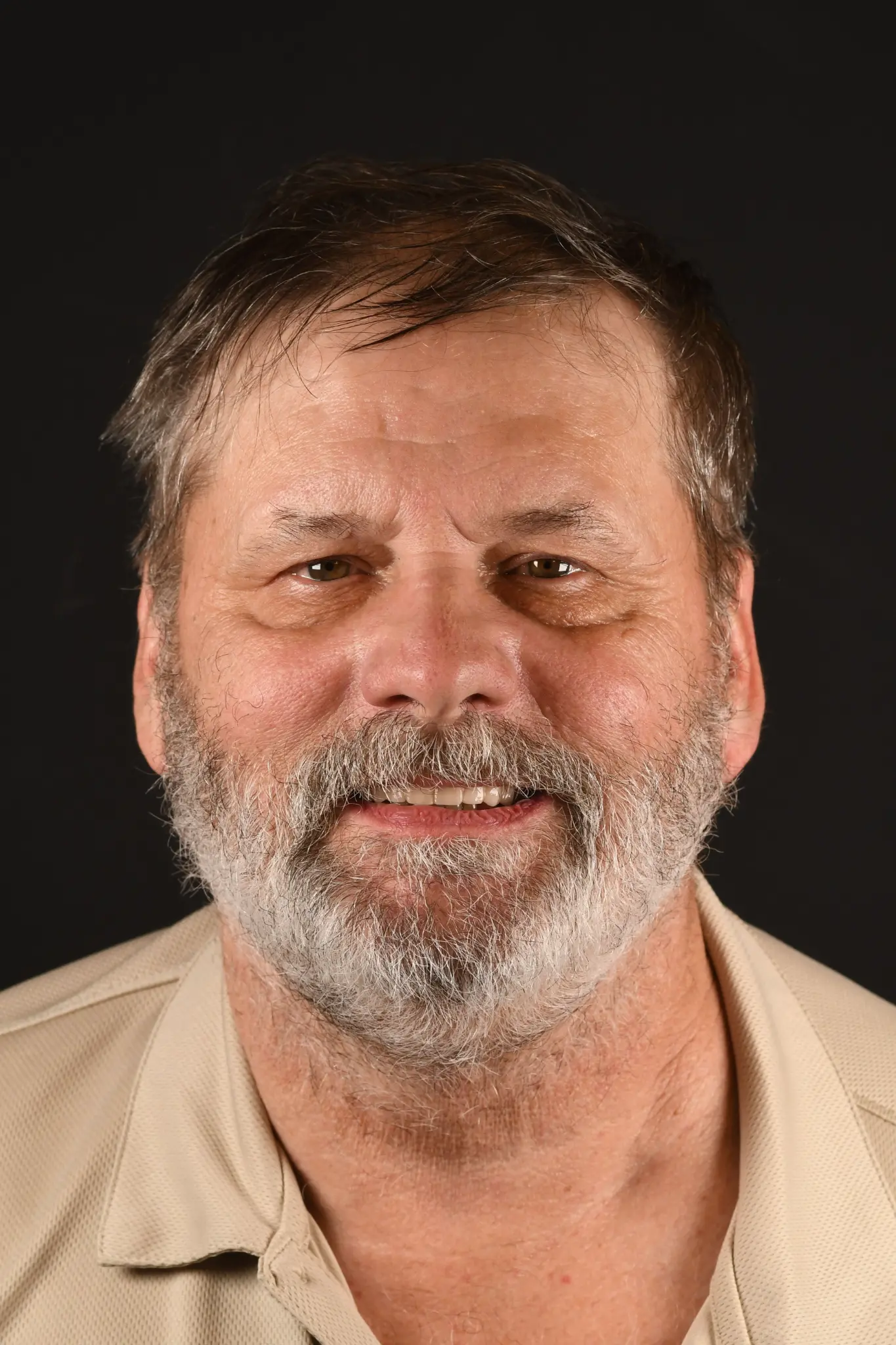 Donald after Upper All-on-X implant treatment with Dr. Constantine