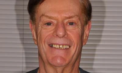Patient smiling before All-on-X implant rehabilitation