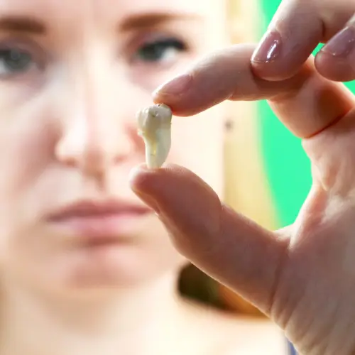 Woman holding up an extracted tooth between her fingers