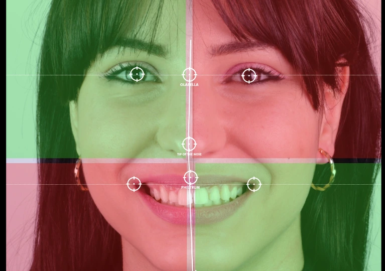 Digital Smile Design simulation of a new smile on screen